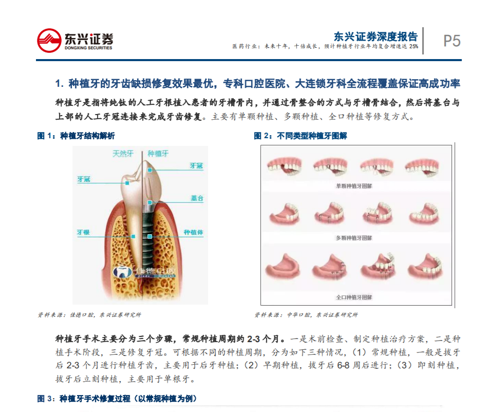 未來十年，十倍成長，預(yù) 計(jì)種植牙行業(yè)年均復(fù)合增速達(dá)25%——東興證券